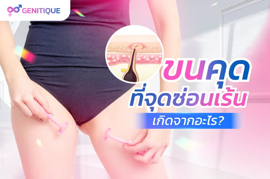 ขนคุดที่จุดซ่อนเร้นเกิดจากอะไร