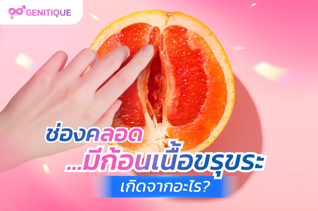 ช่องคลอดมีก้อนเนื้อขรุขระ