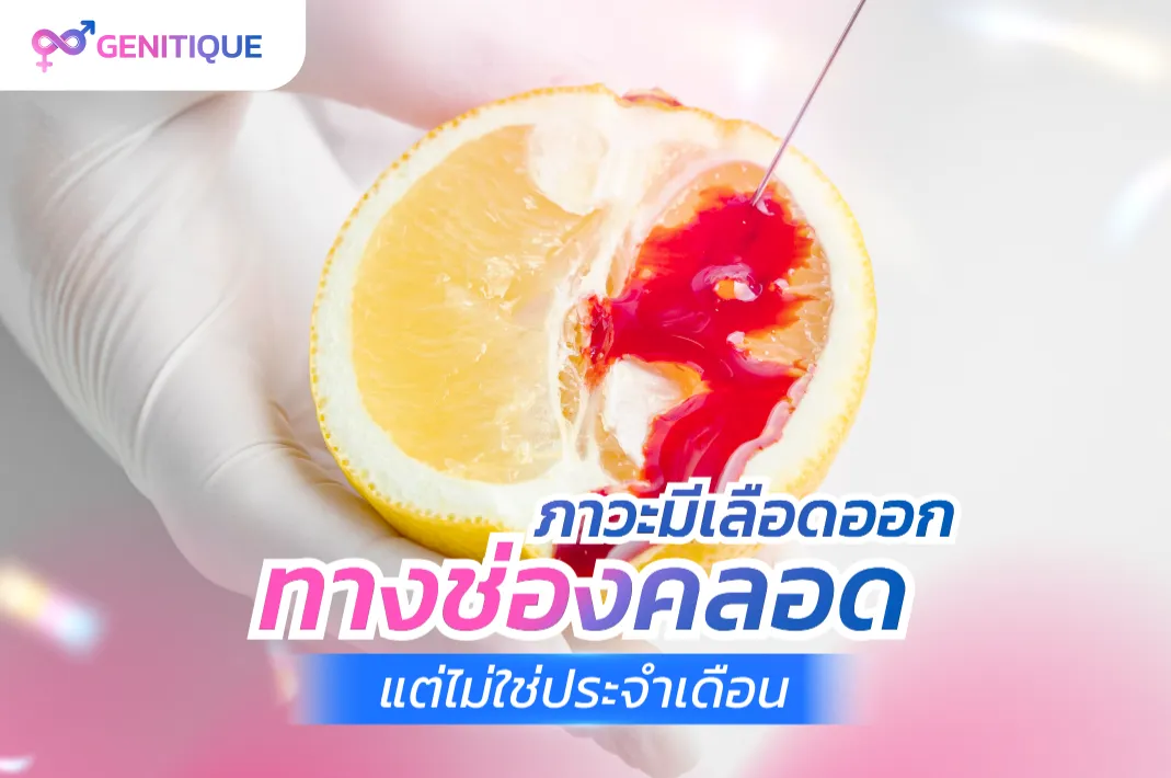 ภาวะมีเลือดออกทางช่องคลอดแต่ไม่ใช่ประจำเดือน