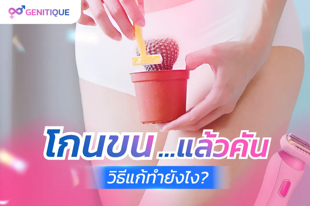 โกนขนที่จุดซ่อนเร้นแล้วคัน
