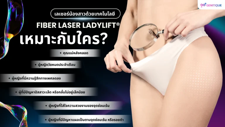 เลเซอร์น้องสาวด้วย เทคโนโลยี Fiber Laser Ladylift® เหมาะกับใคร