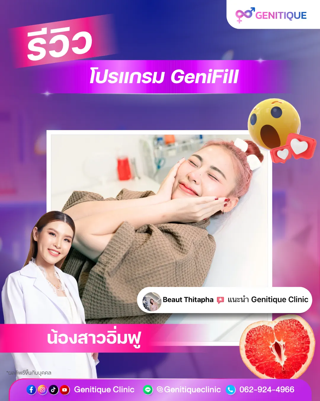 รายละเอียดและจุดเด่นของโปรแกรม GeniFill ฟิลเลอร์น้องสาว Genitique Clinic