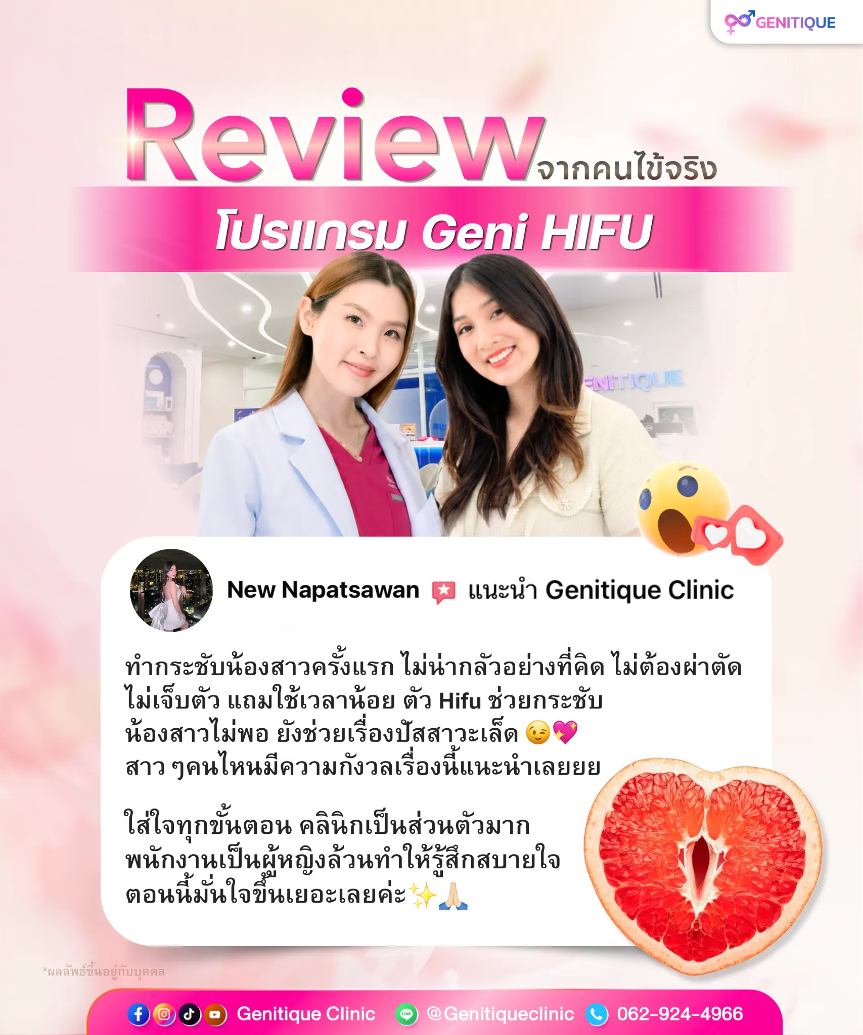 รีวิว GeniHIFU กระชับช่องคลอด คุณนิว Genitique Clinic หมอหนึ่ง